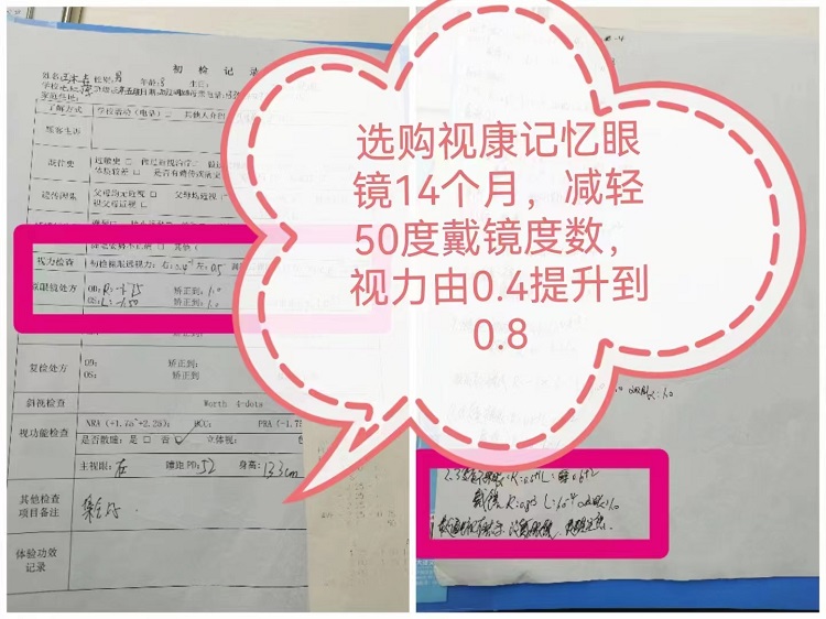 戴视康记忆眼镜14个月近视度数没有上涨