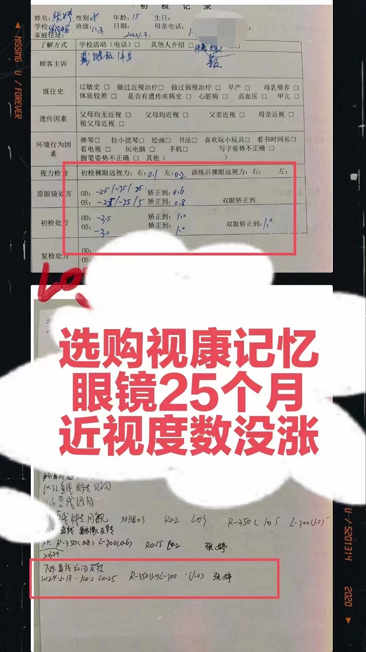 选购视康记忆眼镜25个月度数没有涨